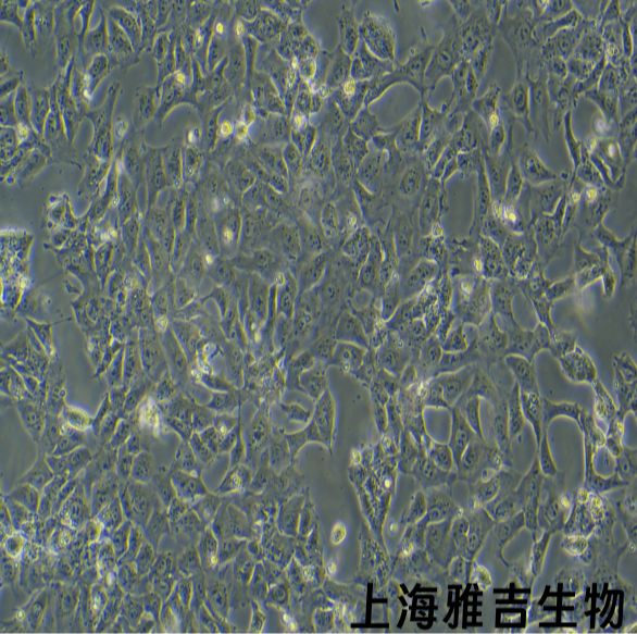 人食道鳞状细胞癌kyse410（STR）