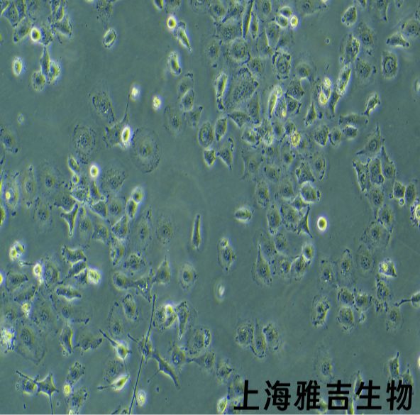 人喉癌细胞LCC（STR）