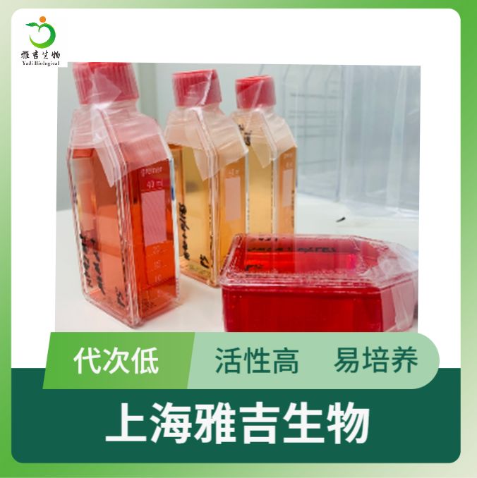 人喉癌淋巴结转移细胞LLNLLN（STR）