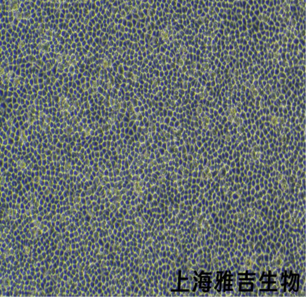 人结直肠癌细胞LOVO（STR）