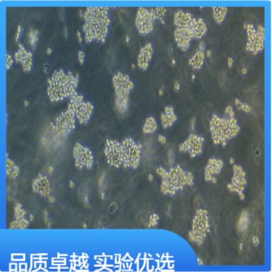 LX-2人肝星形细胞（文献引用产品）
