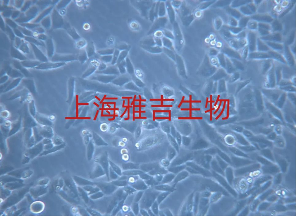 人胃腺癌细胞MKN28（STR）
