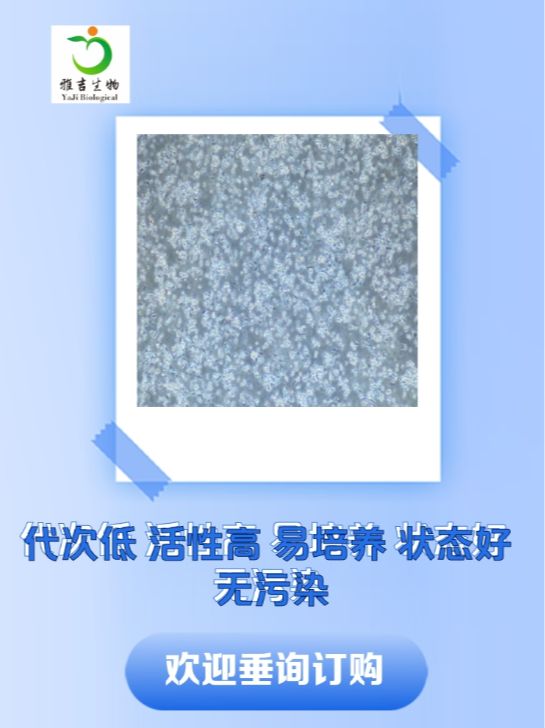 人IgA-?骨髓瘤细胞浆细胞骨髓瘤MM.1S（STR）