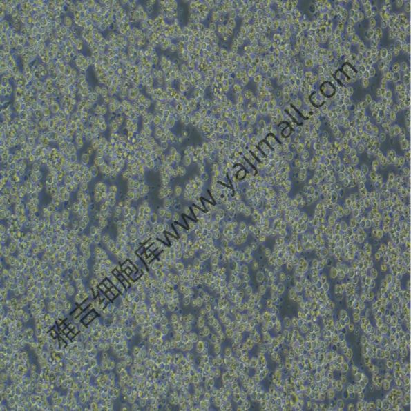 人子宫颈表皮癌细胞MS751（STR）