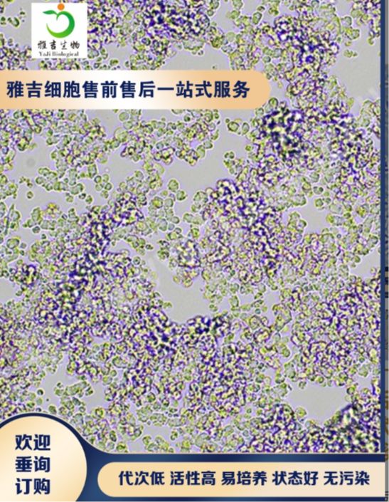 人畸胎癌细胞NCCIT（STR）