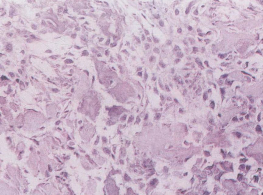 NCI-H1688人小细胞肺癌细胞（STR）