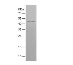 Recombinant Human ACTL6A.png
