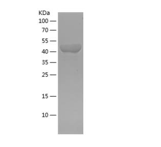 Recombinant Human ACTN1.png