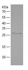 Recombinant Human ACTN3.jpg