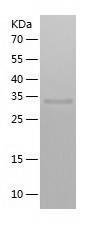 Recombinant Human ACTR8.jpg