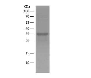 Recombinant Human ACVR1B.png