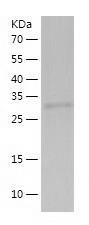 Recombinant Human Acyl-coenzyme A Thioesterase 8.jpg