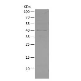 Recombinant Human ADA.png