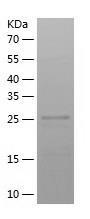 Recombinant Human ADAMTS18.jpg