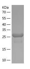 Recombinant Human ADCK2.jpg