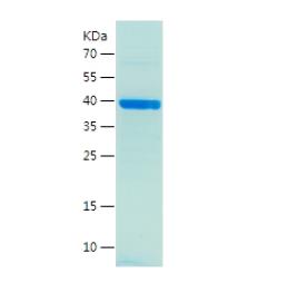 Recombinant Human ADCY3.png
