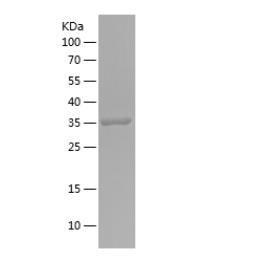 Recombinant Human ADH5.png