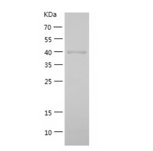 Recombinant Human ADH6.png
