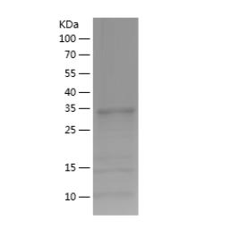 Recombinant Human ADO.png
