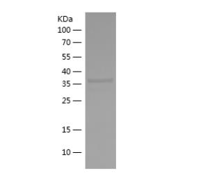 Recombinant Human AGER.png