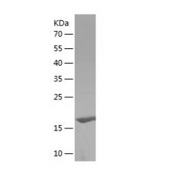 Recombinant Human AGR2.png