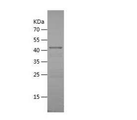 Recombinant Human AHSG.png