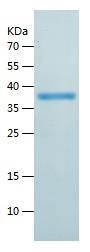 Recombinant Human AKR1C1.jpg