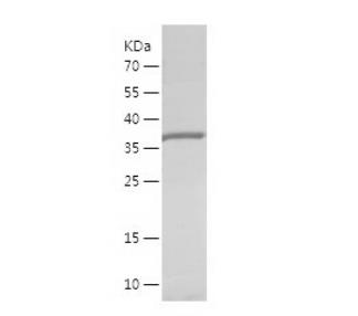 Recombinant Human AKR1C2.png