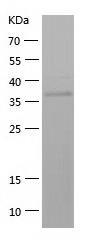 Recombinant Human AKR1C4.jpg