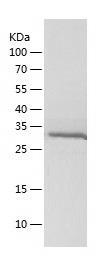 Recombinant Human AKR1D1.jpg