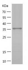 Recombinant Human AKR7A2.jpg