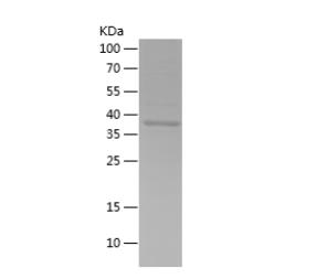 Recombinant Human AKT2.png