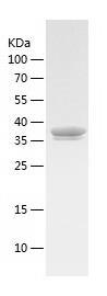 Recombinant Human ALAD.jpg