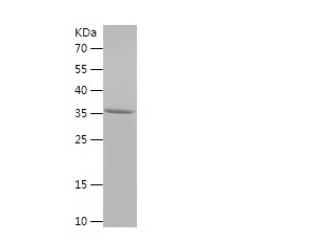 Recombinant Human ALDH1A1.png