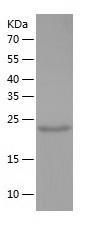 Recombinant Human ALDH3B2.jpg