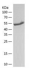 Recombinant Human ALDH5A1.jpg