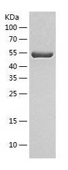 Recombinant Human ALDH6A1.jpg