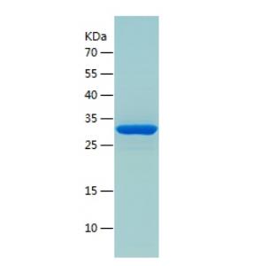 Recombinant Human alpha Actinin.png