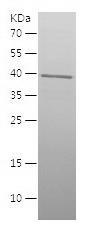 Recombinant Human alpha Actinin 4.jpg