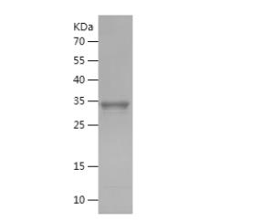 Recombinant Human ALPL.png