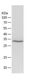 Recombinant Human AMMECR1L.jpg
