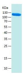 Recombinant Human Amyloid Precursor.jpg