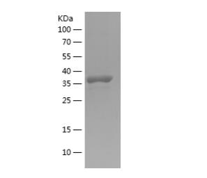 Recombinant Human ANGPTL2.png