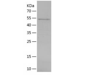 Recombinant Human ANGPTL6.png