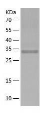 Recombinant Human ANKRA2.jpg