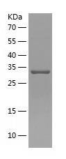 Recombinant Human ANKRD54.jpg