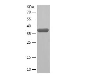 Recombinant Human Annexin-8.png