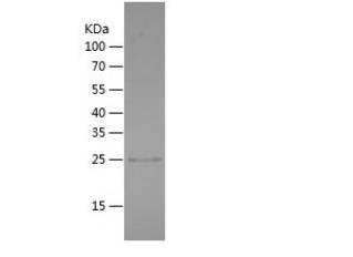 Recombinant Human APCS.png