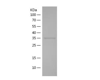 Recombinant Human APEX1.png