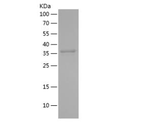 Recombinant Human APOB.png